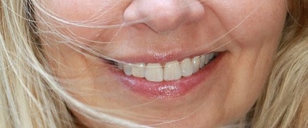 Stomatolog - leczenie zębów